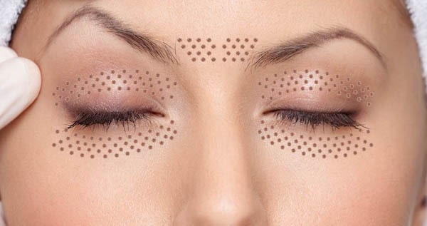 Core.Domain.Models.Image