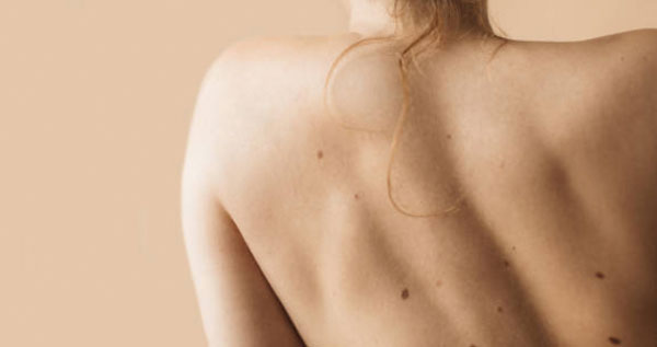 Core.Domain.Models.Image