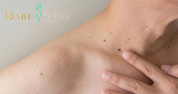 Core.Domain.Models.Image