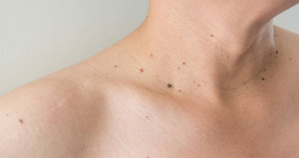 Core.Domain.Models.Image