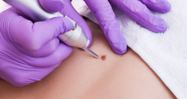 Core.Domain.Models.Image