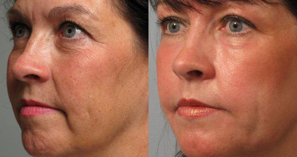 Core.Domain.Models.Image