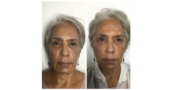 Core.Domain.Models.Image