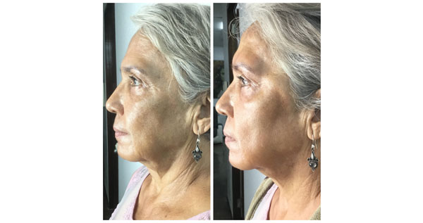 Core.Domain.Models.Image