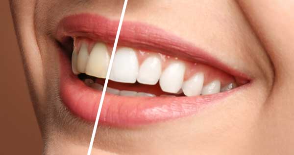 Core.Domain.Models.Image