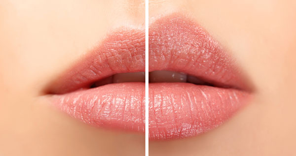 Core.Domain.Models.Image