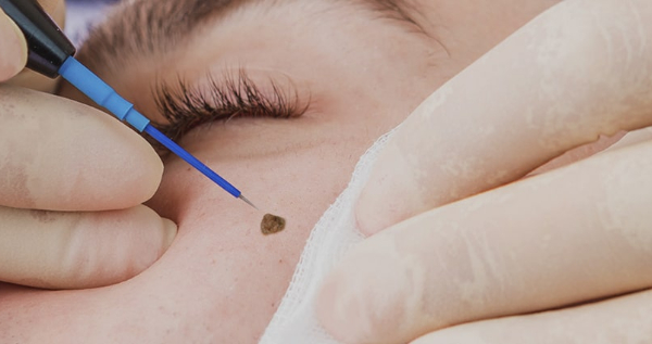 Core.Domain.Models.Image