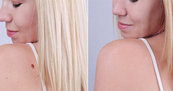 Core.Domain.Models.Image