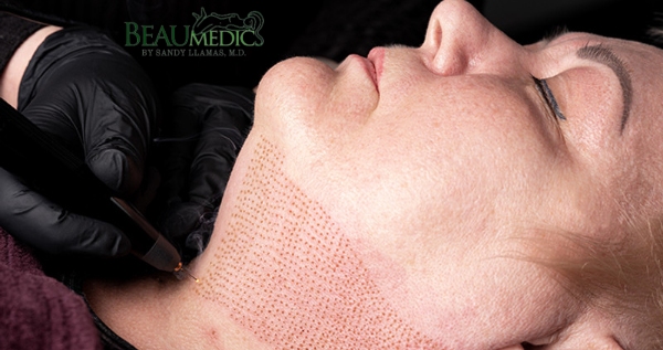 Core.Domain.Models.Image