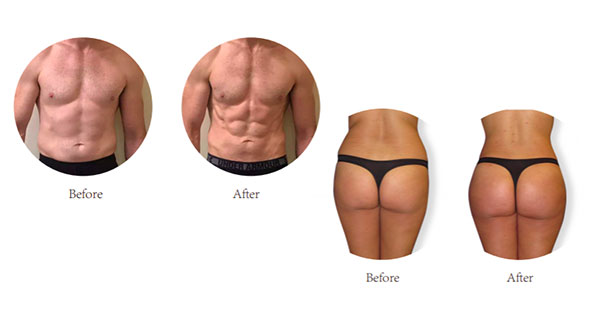 Core.Domain.Models.Image