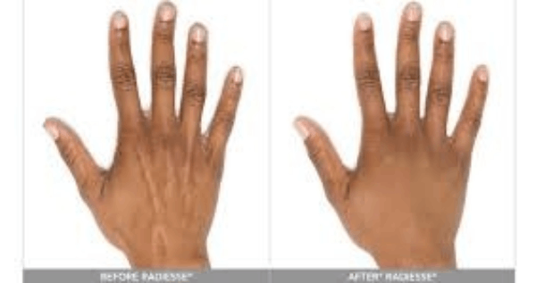 Core.Domain.Models.Image