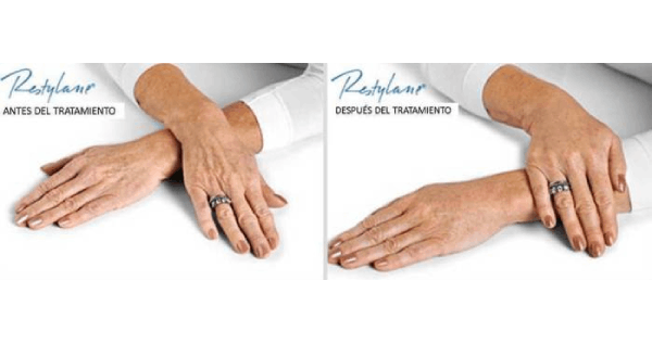 Core.Domain.Models.Image