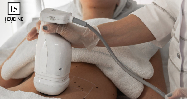 Core.Domain.Models.Image