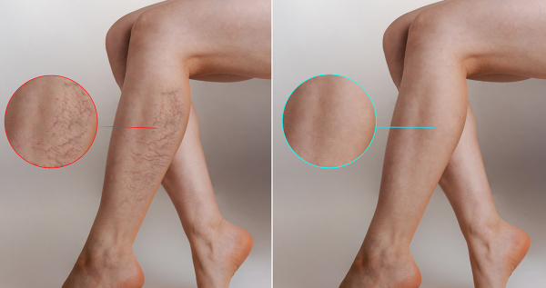 Core.Domain.Models.Image