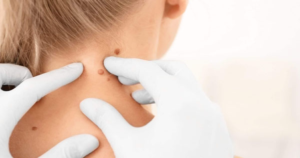 Core.Domain.Models.Image