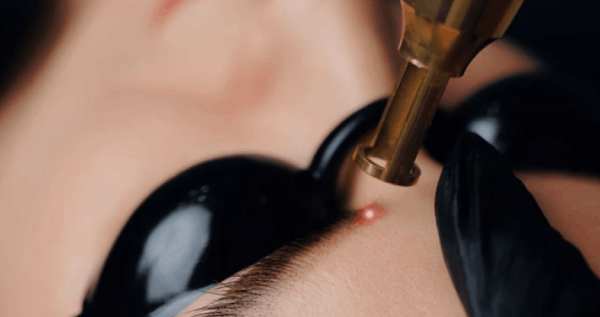 Core.Domain.Models.Image