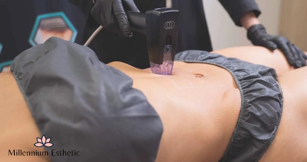 Core.Domain.Models.Image