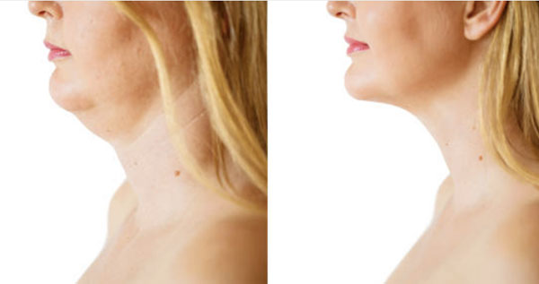 Core.Domain.Models.Image