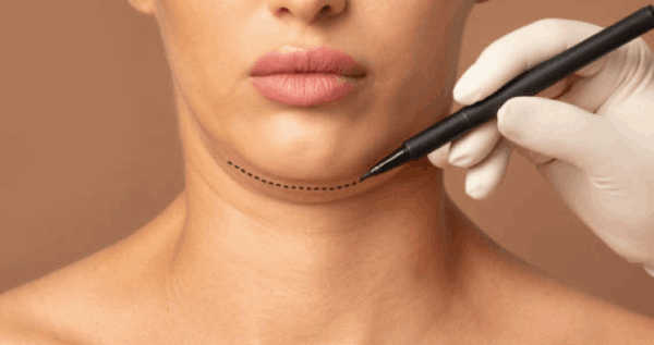 Core.Domain.Models.Image