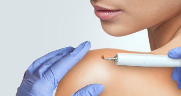 Core.Domain.Models.Image