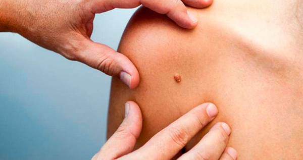 Core.Domain.Models.Image