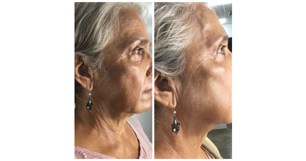 Core.Domain.Models.Image