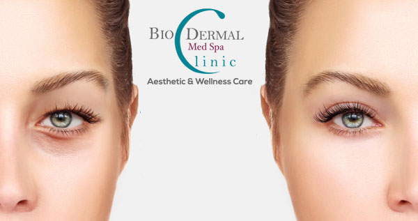 Core.Domain.Models.Image