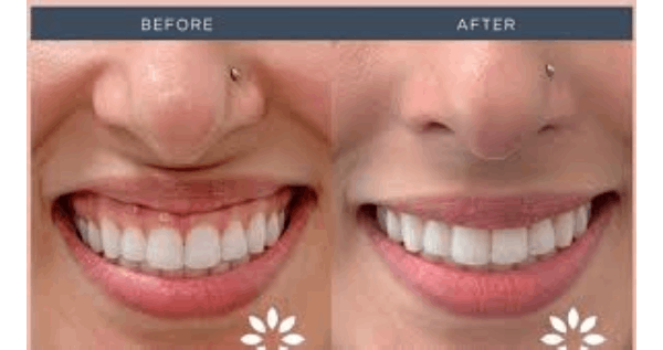 Core.Domain.Models.Image