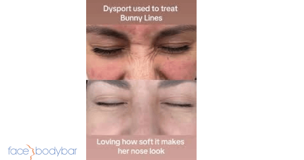 Core.Domain.Models.Image