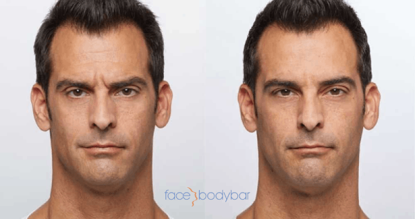 Core.Domain.Models.Image