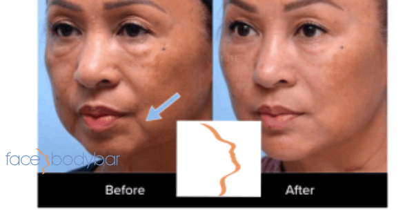 Core.Domain.Models.Image