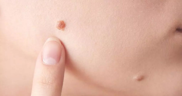 Core.Domain.Models.Image