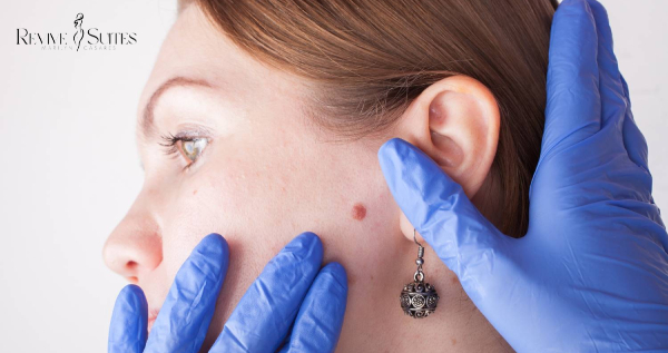 Core.Domain.Models.Image