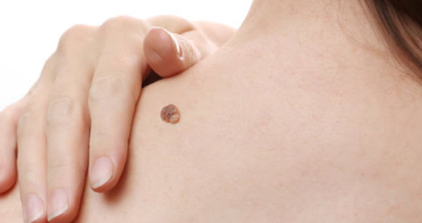 Core.Domain.Models.Image